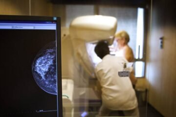 Hasta 7.500 mujeres en España esperan para acceder a terapias innovadoras contra la recaída en cáncer de mama