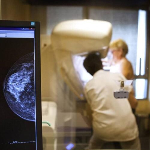 Hasta 7.500 mujeres en España esperan para acceder a terapias innovadoras contra la recaída en cáncer de mama
