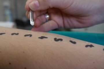 La alergia será aún peor esta primavera en España por las lluvias de récord: la advertencia sobre el polen de los alergólogos