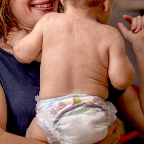 La Fiscalía pide la absolución para los acusados en el caso de los 21 menores con síndrome del hombre lobo