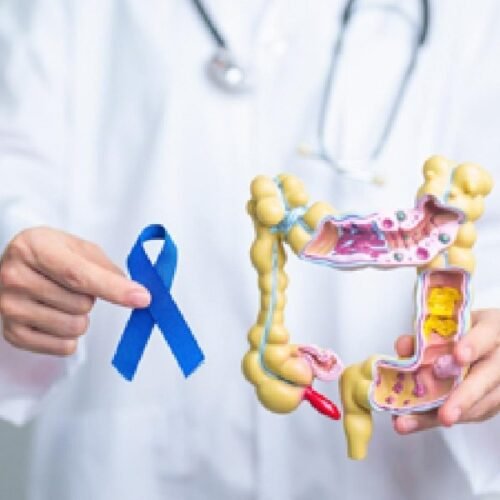 Cataluña amplía el programa de detección de cáncer de colon hasta los 74 años