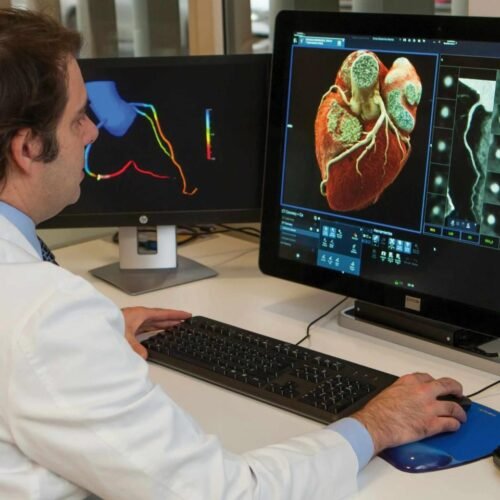 La preocupante relación entre una mala alimentación y los infartos: ya causa el 43% de las muertes en el mundo