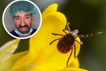 David Callejo, médico, sobre quitar las garrapatas sin peligro: «Esto aumenta el riesgo de que el insecto vomite y te contagie infecciones»