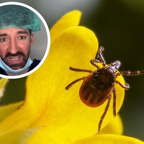 David Callejo, médico, sobre quitar las garrapatas sin peligro: «Esto aumenta el riesgo de que el insecto vomite y te contagie infecciones»